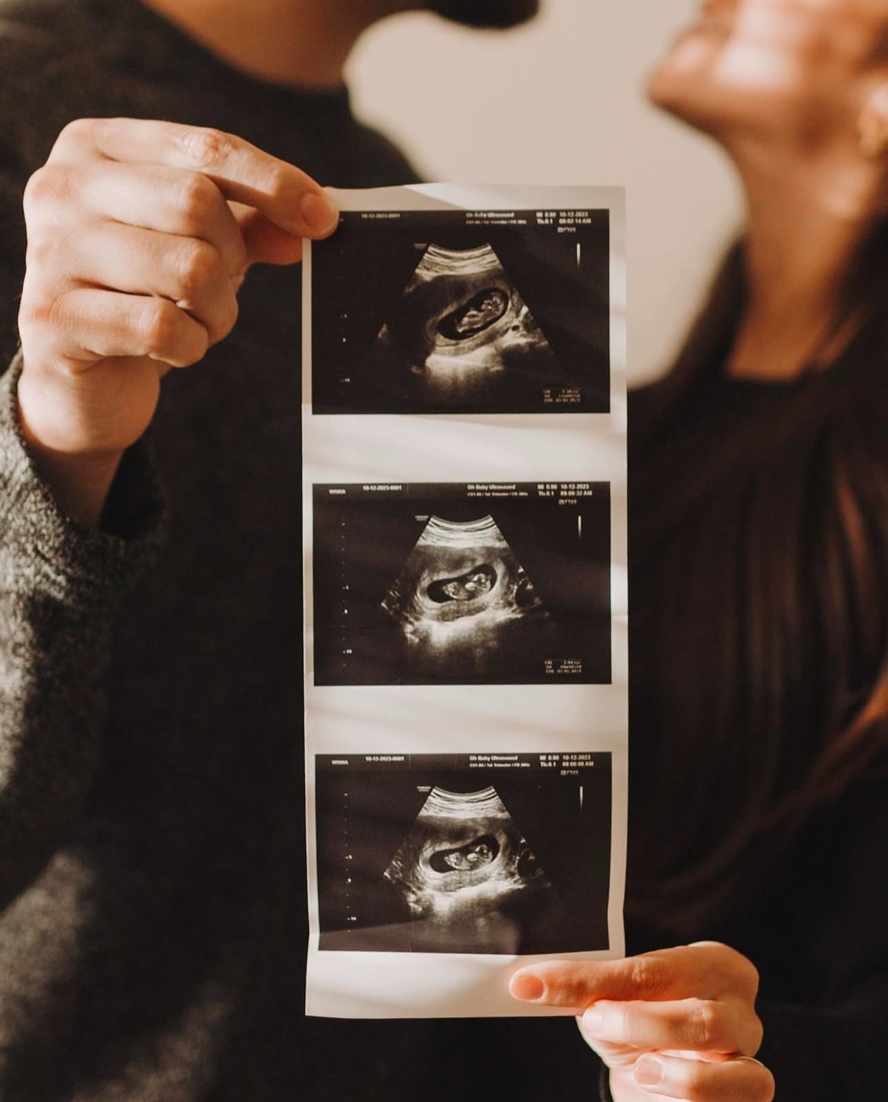 HD ultrasound Nashville TN