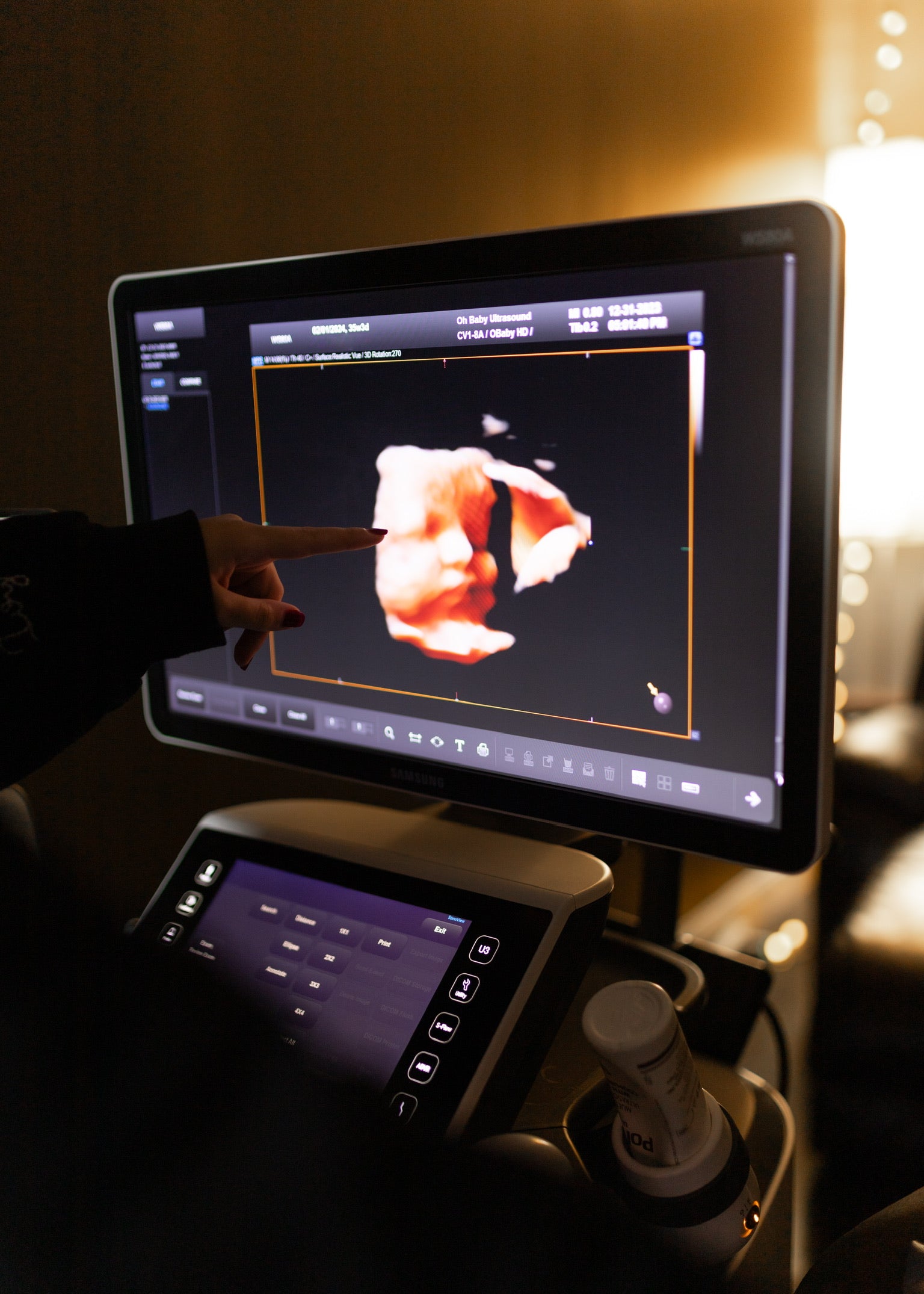 Baby ultrasound Nashville, TN