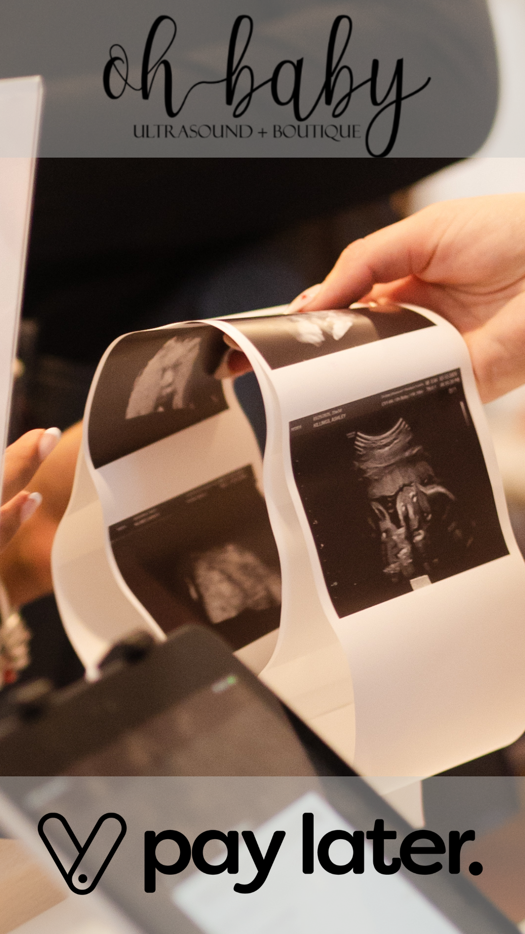 Oh Baby Ultrasound + Boutique pay later option