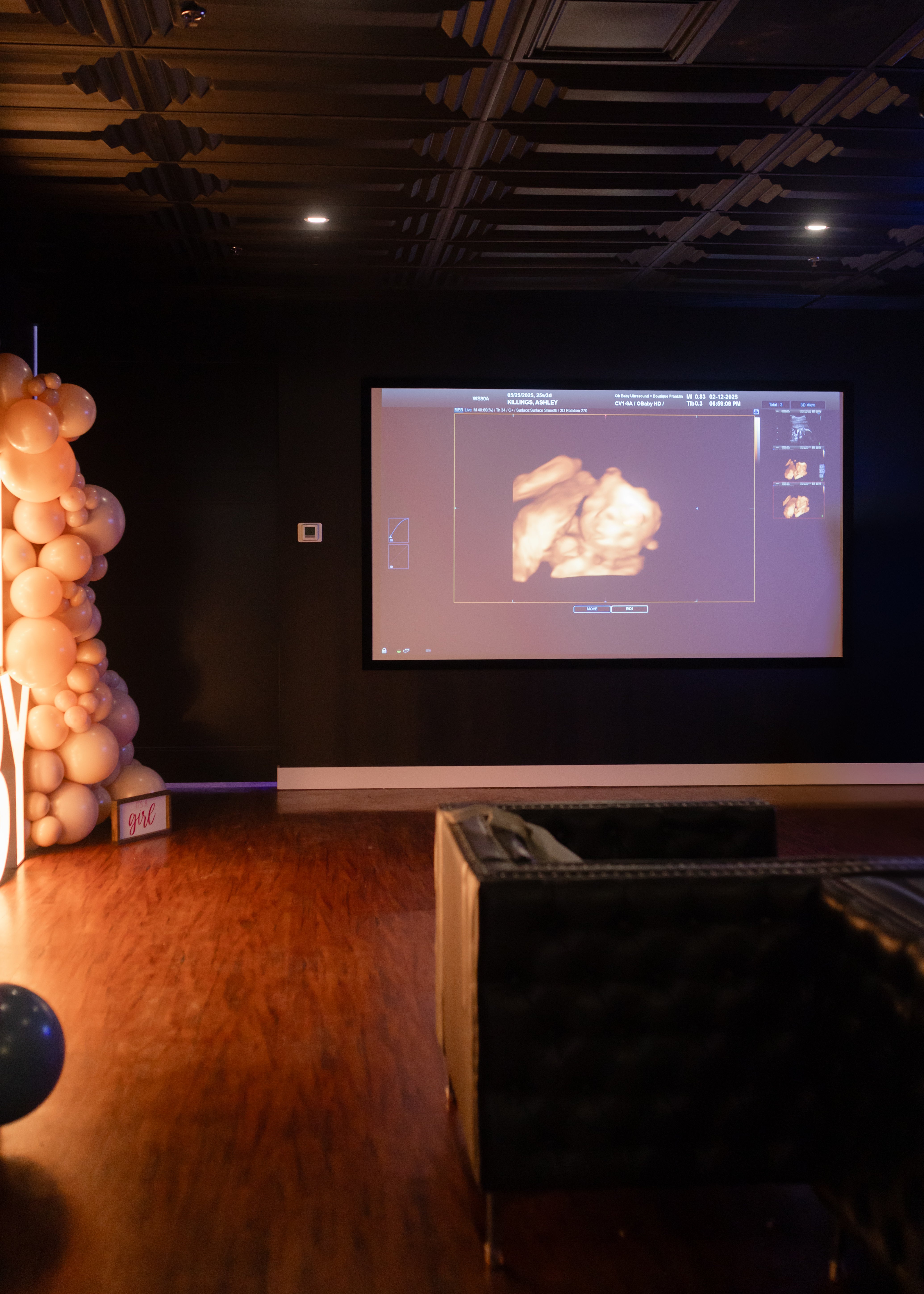 Prenatal ultrasound Franklin TN