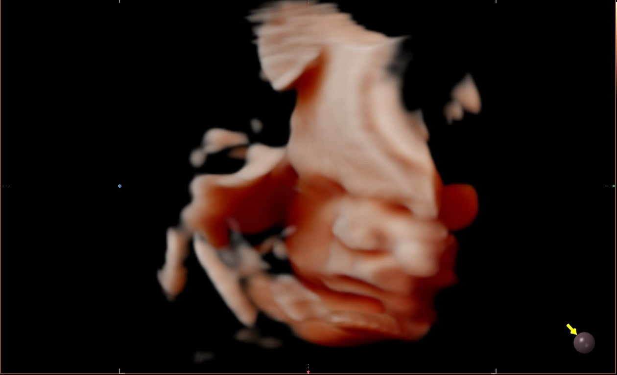 8K Ultrasound Image