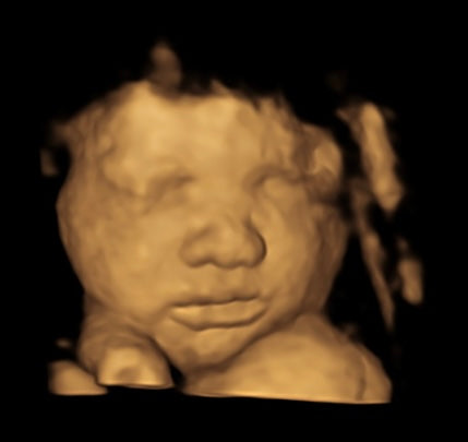3D ultrasound to 8K image