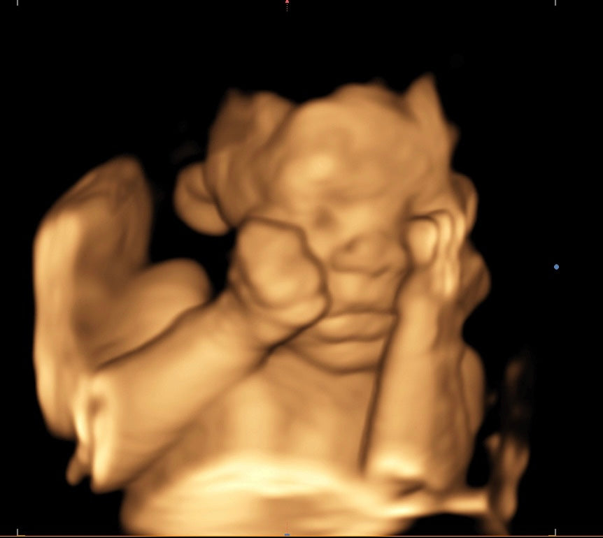 Hendersonville 3D 4D ultrasound